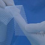 picture of surgeon holding a piece of hernia mesh